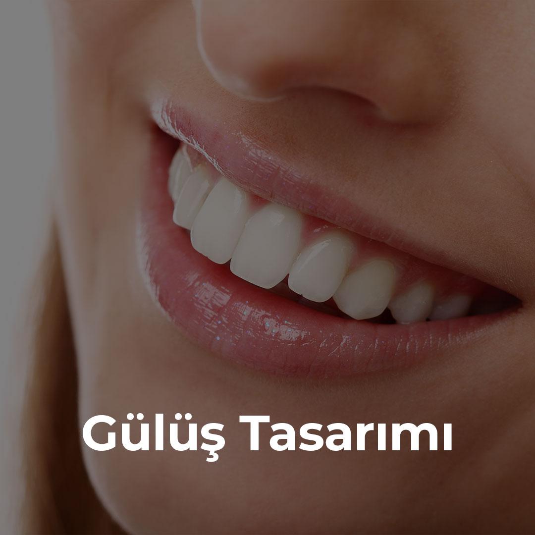 Gülüş Tasarımı