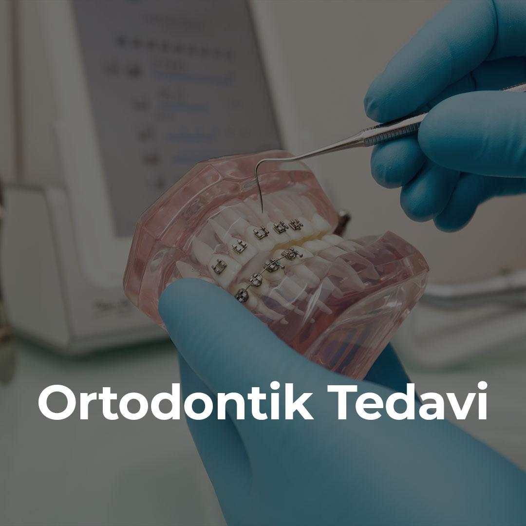 Ortodontik Tedavi